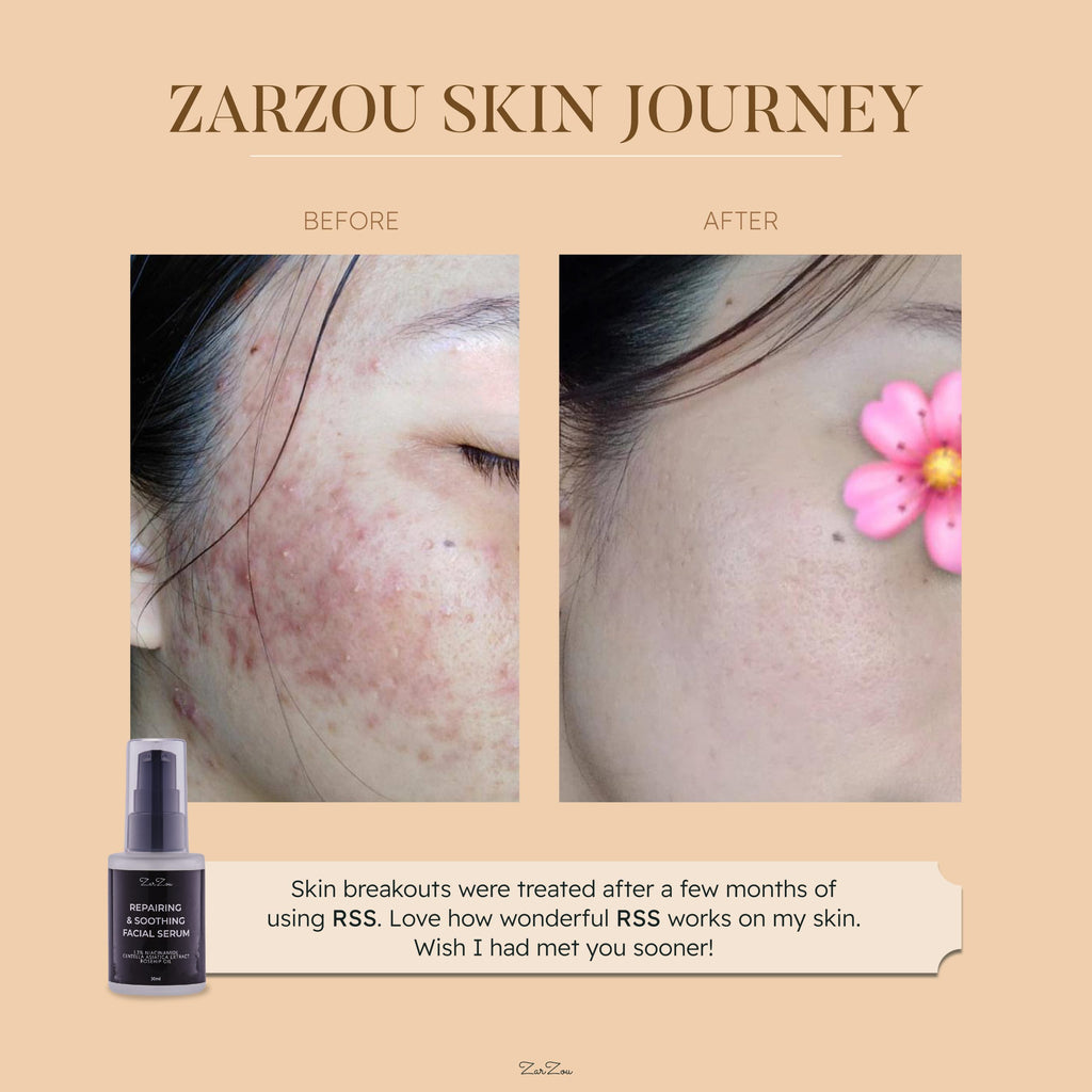 zarzou-repairing-soothing-facial-serum