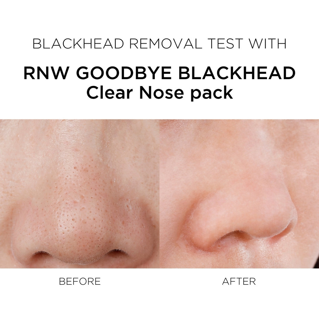 rnw-goodbye-blackhead-2-step-clear-nose-pack
